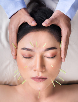 Akupunktura twarzy
