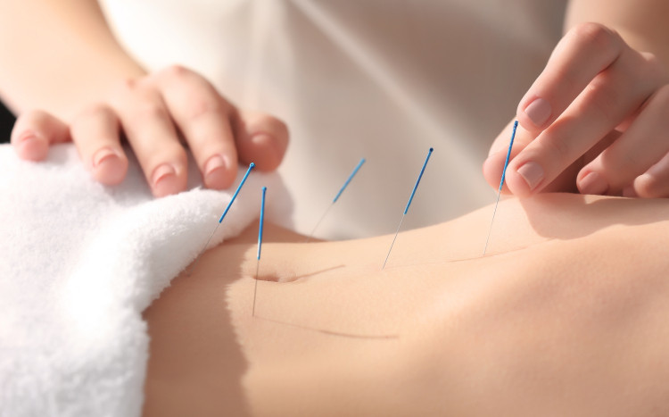 akupunktura brzucha