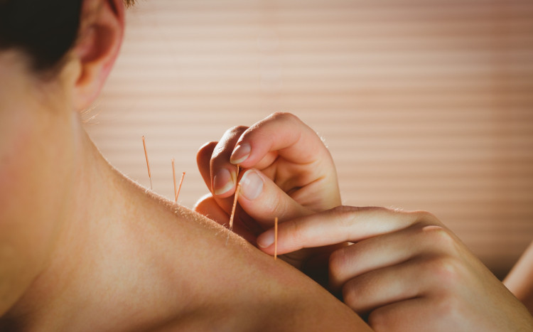 akupunktura na ramiona