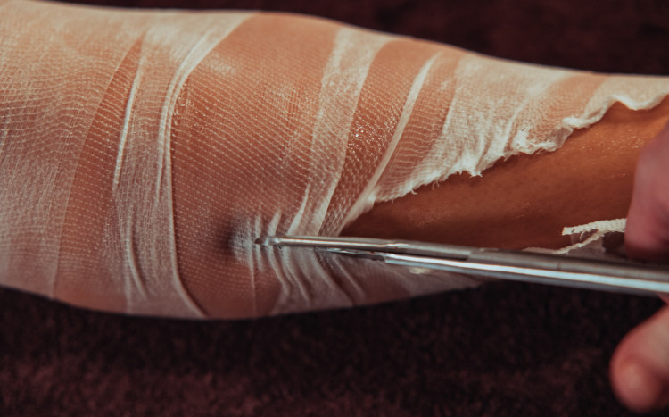 rozcinanie nasączonego kosmetykami bandażu na nodze